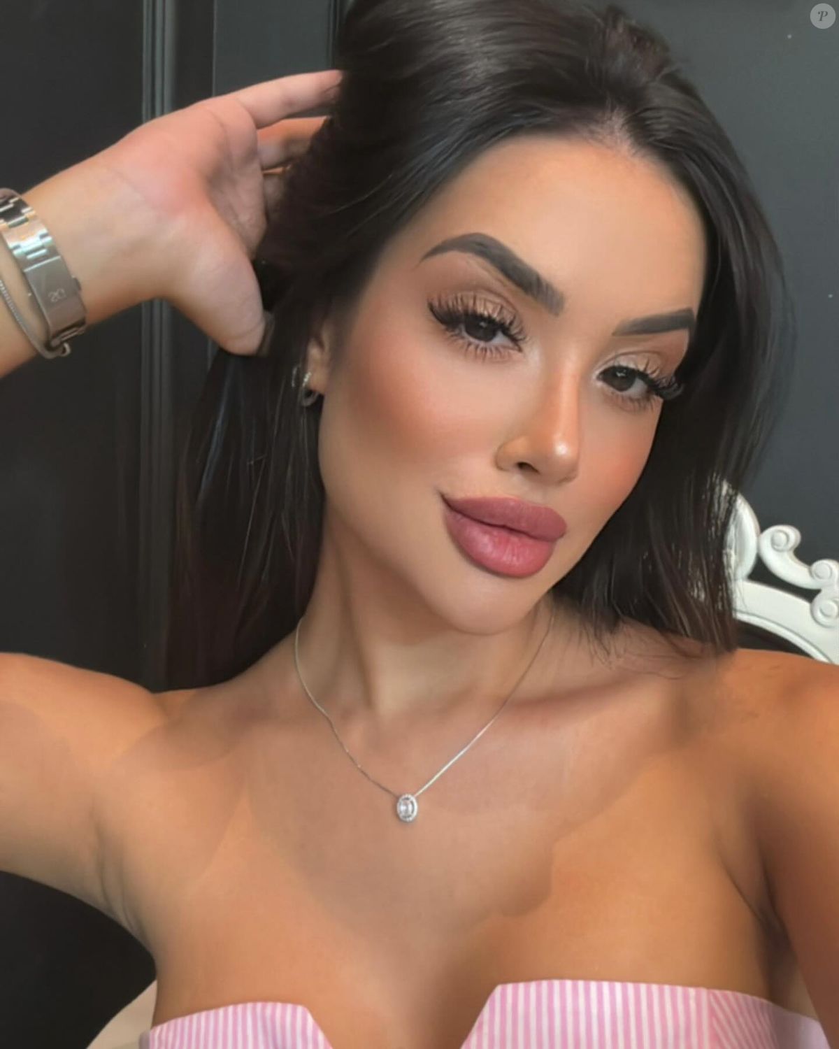 Foto: Jordana apostou em um preenchimento labial que aumentou o volume consideravelmente - Purepeople