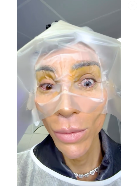 Maya Massafera destacou a diferença entre os olhos logo que mudou a cor do primeiro