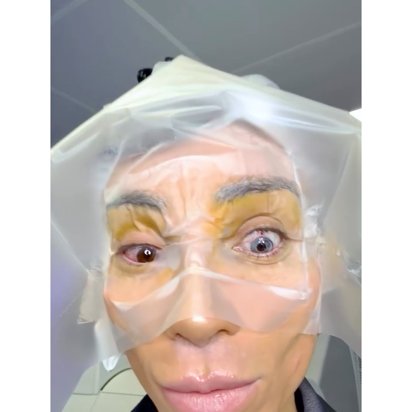 Maya Massafera destacou a diferença entre os olhos logo que mudou a cor do primeiro