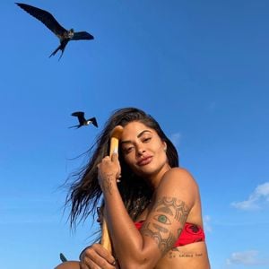 Harmonização de Aline Campos valorizou seus contornos, especialmente na mandíbula