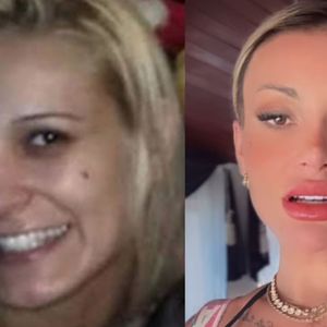Antes e depois de Andressa Urach vai impressionar.