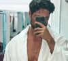 Ângelo Rodrigues, o ator que será Martin em 'Vale Tudo', quase perdeu a vida paós injeção nas nádegas