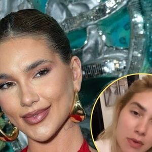 Virgínia sofre com doença incurável que a proibiu de comer chocolate; médico explica e faz alerta: 'A tendência é ela piorar'