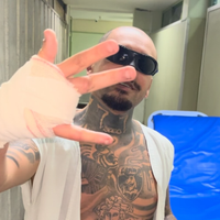 O posicionamento oficial do Rock in Rio sobre streamer que perdeu um dedo ao pular grade em área restrita