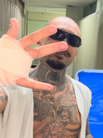 O posicionamento oficial do Rock in Rio sobre streamer que perdeu um dedo ao pular grade em área restrita