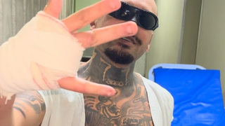 O posicionamento oficial do Rock in Rio sobre streamer que perdeu um dedo ao pular grade em área restrita