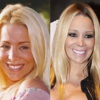 Antes e depois de Danielle Winits: atriz mudou aparência com plástica e transformação em 32 anos é surpreendente. Veja 34 fotos!