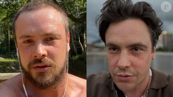 Galã de qualquer forma, Sérgio Guizé realizou o transplante capilar há alguns anos e renovou sua beleza