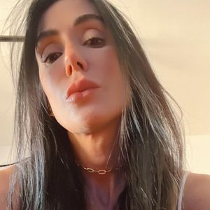 Michelle Barros fez preenchimentos em diversas áreas do rosto na tentativa de harmonizá-lo