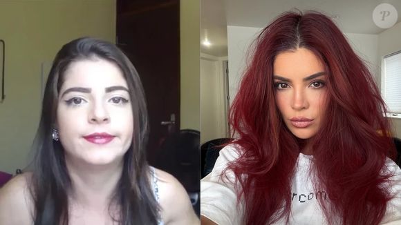 Gkay mudou muito com procedimentos estéticos, mas acabou exagerando. Recentemente, ela diminuiu o seu preenchimento labial