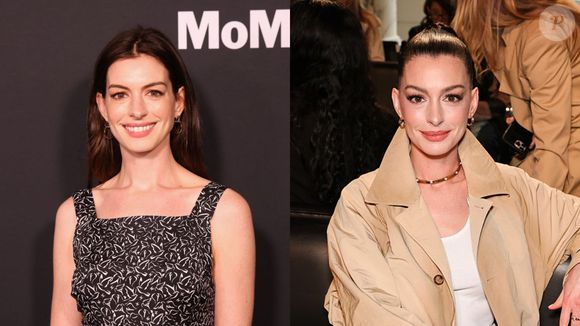Antes e depois de Anne Hathaway: atriz passou por um rejuvenescimento notório que fãs julgaram ter sido fruto de um facelift