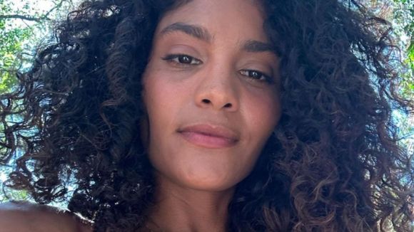 Condição crônica de Bárbara Reis ainda é pouco diagnosticada no Brasil