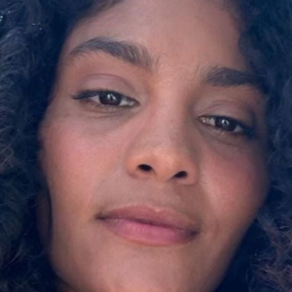 Condição crônica de Bárbara Reis ainda é pouco diagnosticada no Brasil