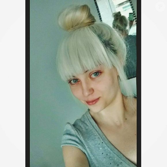 Barbie Humana afinou e diminuiu o seu nariz com plásticas