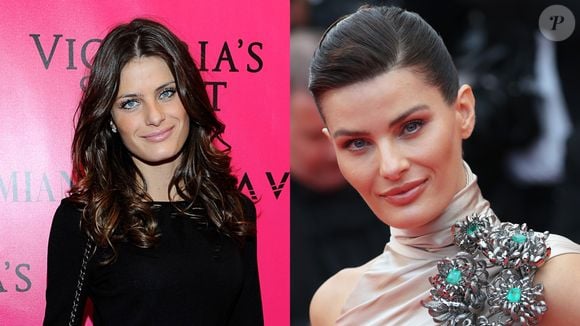 A modelo brasileira Isabeli Fontana foi mais uma que escolheu o botox como forma de prevenção ao envelhecimento