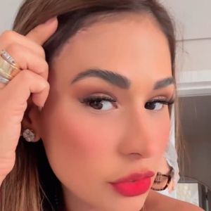 Simone Mendes mostrou o corte no alto da testa, perto da raiz dos cabelos