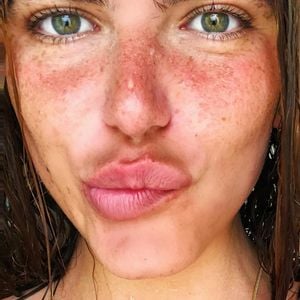 Mariana Goldfarb contou que suas sardas eram sua 'maquiagem de verão' em selfie postada na web