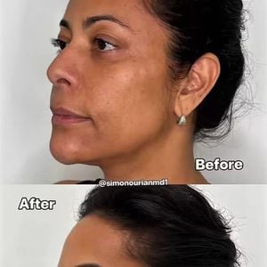 Samantha Schmütz já havia realizado procedimentos com o Dr. Simon Ourian, que assina as transformações da família Kardashian