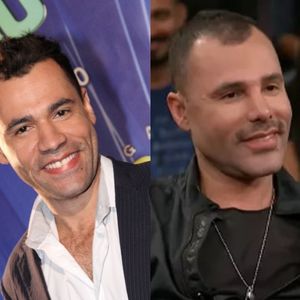 Antes e depois de Rodrigo Sant'Anna: veja como ator da 'Zorra Total' mudou com procedimentos estéticos