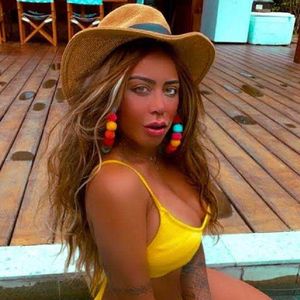 Rafaella Santos também já aplicou botox em algumas áreas do rosto