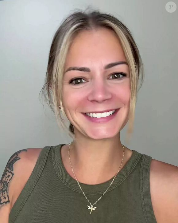 Alisha Monaco contou que sofre com acne cística, que costuma aparecer em períodos de estresse ou antes de eventos importantes.