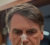 Intimado no hospital, Bolsonaro grita, critica Moraes e assina notificação da ação penal sobre tentativa de golpe