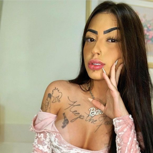 MC Mirella também realizou uma rinoplastia para deixar o nariz menor