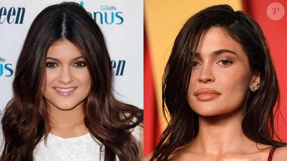 Kylie Jenner mudou da água para o vinho com procedimentos estéticos. Seu preenchimento labial deu destaque para os contornos do rosto