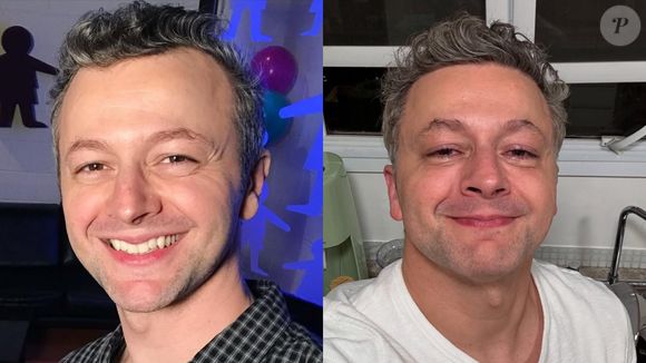 O motivo de autoestima foi o usado pelo cantor Lucas Lima, ex-marido de Sandy, que recorreu à técnica para disfarçar suas entradas