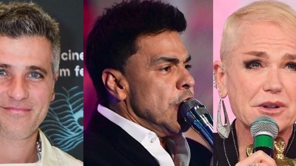 Mudaram muito? Zezé Di Camargo, Xuxa e mais: antes e depois destes 18 famosos que fizeram transplante capilar vai te deixar de queixo caído