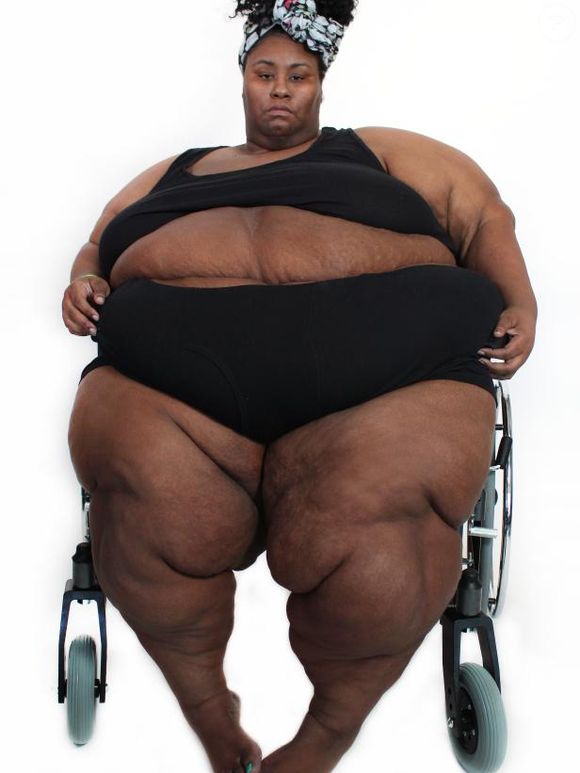 Octavia chegou no 'Quilos Mortais' pesando 314 kg e com a mobilidade reduzida devido ao sobrepeso