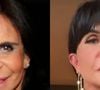 Muito criticada por sua harmonização facial, Gretchen mudou muito seu rosto nos últimos anos