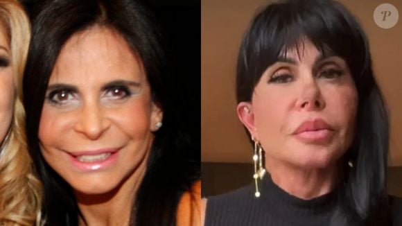 Muito criticada por sua harmonização facial, Gretchen mudou muito seu rosto nos últimos anos