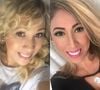 Antes e depois de Taty Girl: veja 25 fotos da mudança radical da cantora após procedimentos estéticos e plásticas