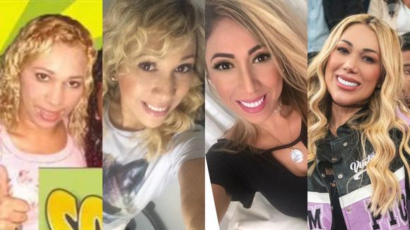 Antes e depois de Taty Girl: veja 25 fotos da mudança radical da cantora após procedimentos estéticos e plásticas