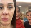 Claudia Raia recorreu a um tratamento com linhas de colágeno para melhorar a qualidade da pele do rosto