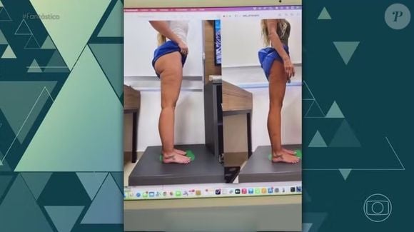 Pernas de Yasmin Brunet desincharam e garantiram um novo aspecto para o visual da modelo