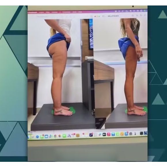 Pernas de Yasmin Brunet desincharam e garantiram um novo aspecto para o visual da modelo