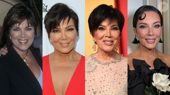Antes e depois de Kris Jenner choca com transformação radical com procedimentos estéticos