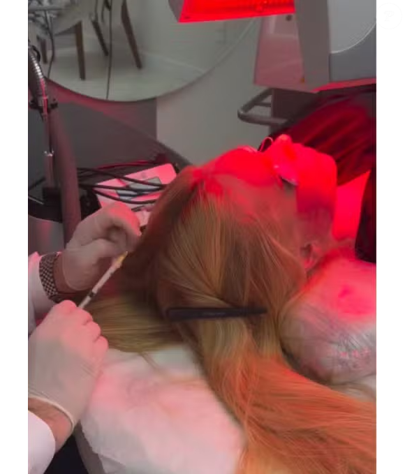 Virgínia Fonseca recebeu novamente o diagnóstico de alopecia recentemente