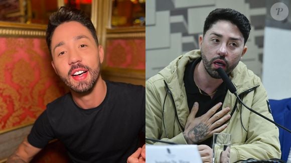 Antes e depois de Rico Melquiades: influenciador causou com lifting facial que foi criticado pelo público
