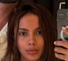 Anitta, após polêmica com procedimento estético, entrega próxima mudança no visual: 'Decidi que vou...'