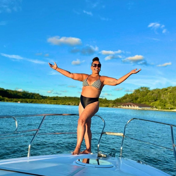 Corpo de Solange Couto já passou por diferentes cirurgias; atriz revelou ter 3 umbigos ao longo dos anos