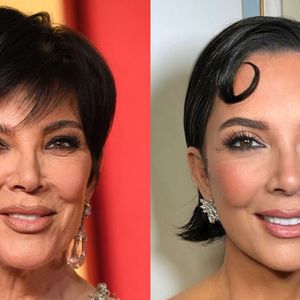 Kris Jenner chocou ao 'mudar de rosto' aos 69 anos após cirurgia plástica