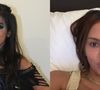 Anitta causou na web ao surgir completamente diferente após novos procedimentos estéticos
