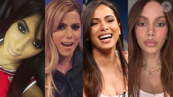 Anitta revelou detalhes sobre o início de sua relação com cirurgias plásticas e relembrou a pressão por beleza que recebeu no começo da carreira