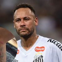 Neymar expõe ferimentos após jogo do Santos e levanta debate sobre nova lesão grave: 'Podem virar longos 10 meses'