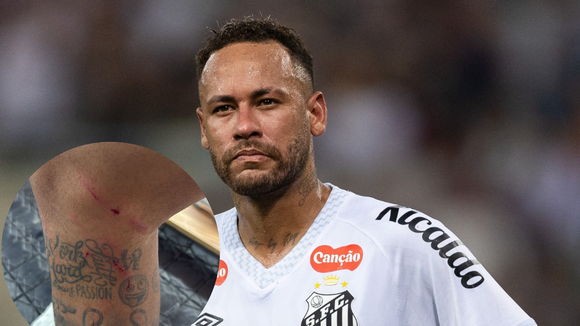 Neymar expõe ferimentos após jogo do Santos e levanta debate sobre nova lesão grave: 'Podem virar longos 10 meses'