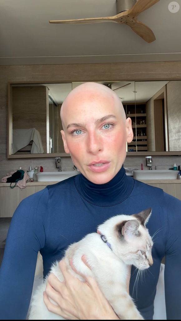 Dani Gondim foi diagnosticada com linfoma no mediastino, um câncer do sistema linfático localizado na região central do tórax