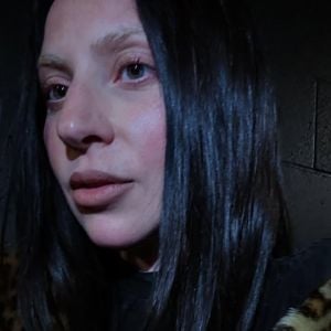 Doença de Lady Gaga: a SBR define a fibromialgia como uma síndrome clínica que se manifesta com dor no corpo todo, principalmente na musculatura